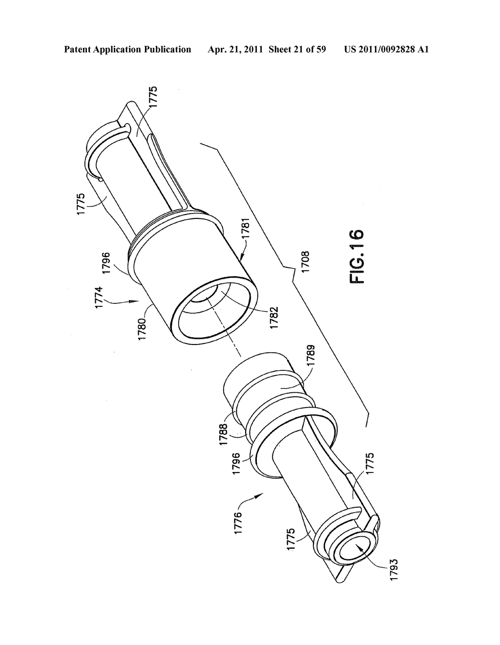 Fluid Delivery System, Fluid Path Set, and Pressure Isolation Mechanism with Hemodynamic Pressure Dampening Correction - diagram, schematic, and image 22