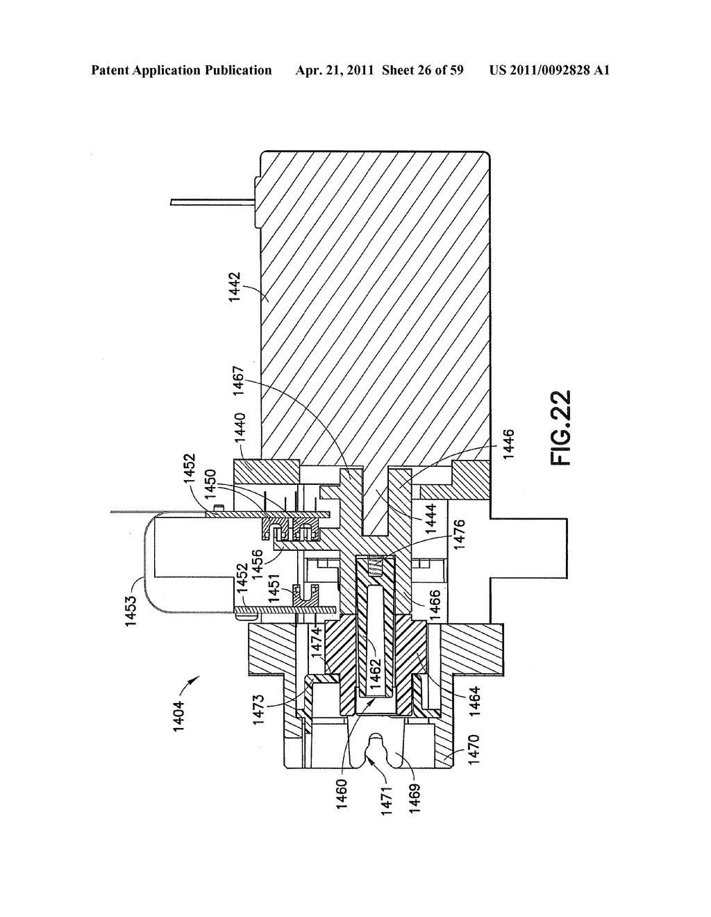 Fluid Delivery System, Fluid Path Set, and Pressure Isolation Mechanism with Hemodynamic Pressure Dampening Correction - diagram, schematic, and image 27