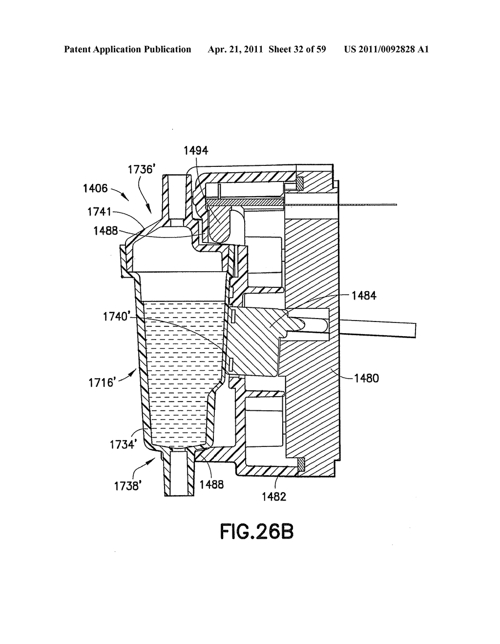 Fluid Delivery System, Fluid Path Set, and Pressure Isolation Mechanism with Hemodynamic Pressure Dampening Correction - diagram, schematic, and image 33