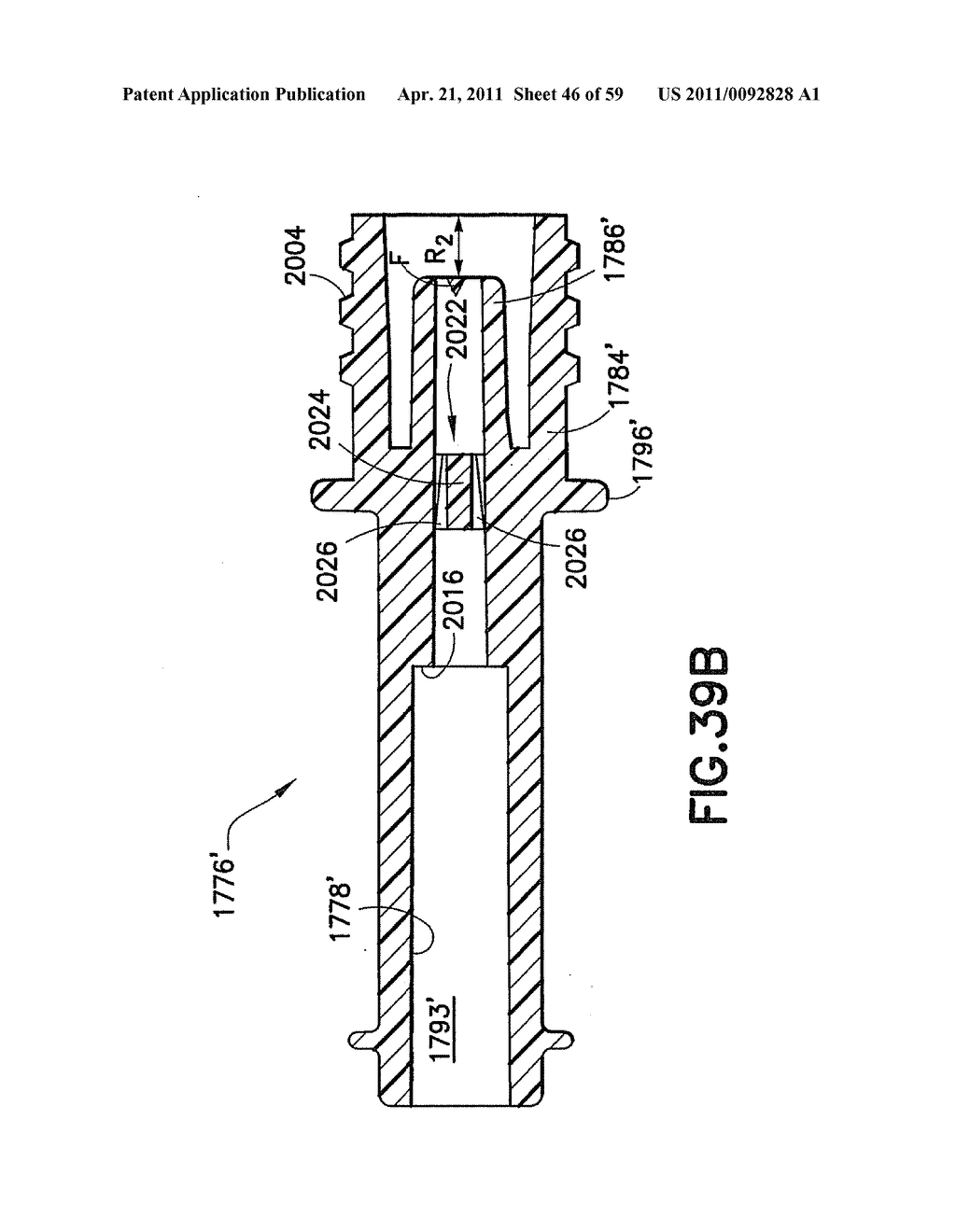 Fluid Delivery System, Fluid Path Set, and Pressure Isolation Mechanism with Hemodynamic Pressure Dampening Correction - diagram, schematic, and image 47