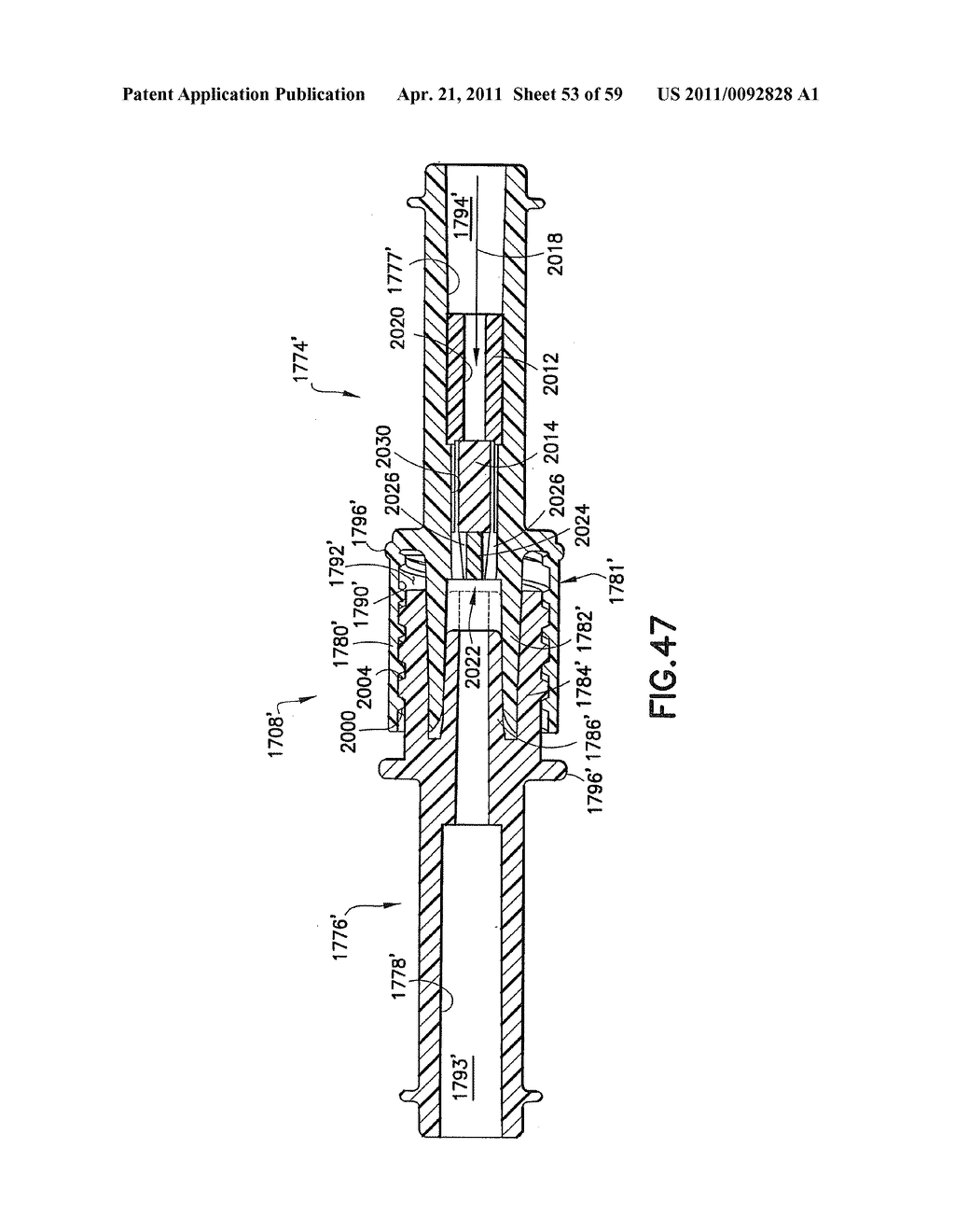 Fluid Delivery System, Fluid Path Set, and Pressure Isolation Mechanism with Hemodynamic Pressure Dampening Correction - diagram, schematic, and image 54