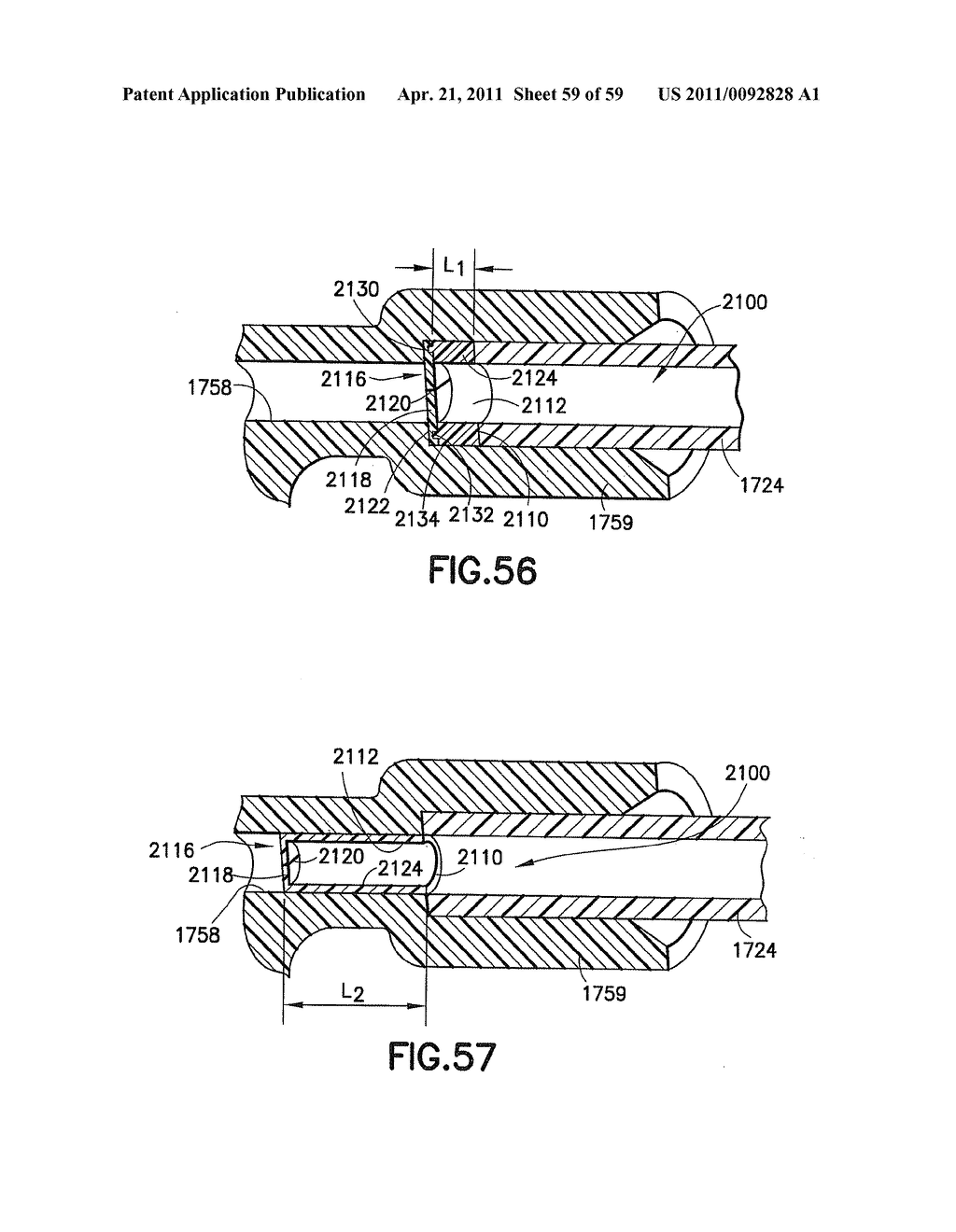 Fluid Delivery System, Fluid Path Set, and Pressure Isolation Mechanism with Hemodynamic Pressure Dampening Correction - diagram, schematic, and image 60