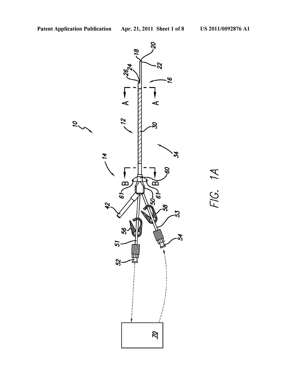 Chronic Hemodialysis Catheter with Balloon - diagram, schematic, and image 02