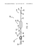 Chronic Hemodialysis Catheter with Balloon diagram and image