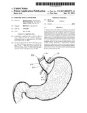 BARIATRIC DEVICE AND METHOD diagram and image