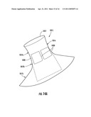 BARIATRIC DEVICE AND METHOD diagram and image