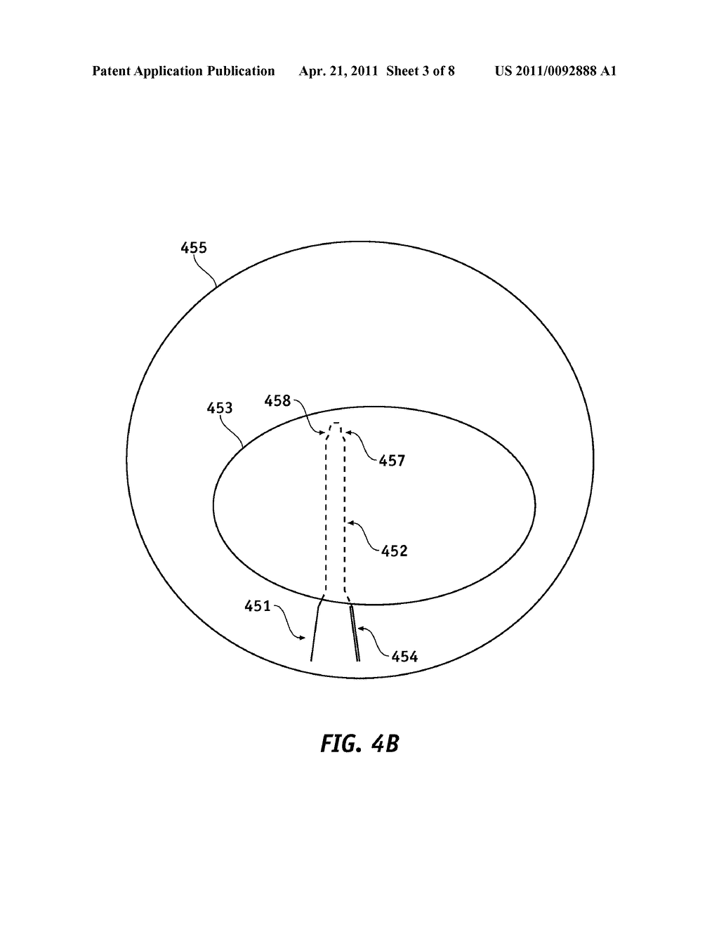 ROTATIONAL ALIGNMENT OF FLUID DELIVERY DEVICE - diagram, schematic, and image 04