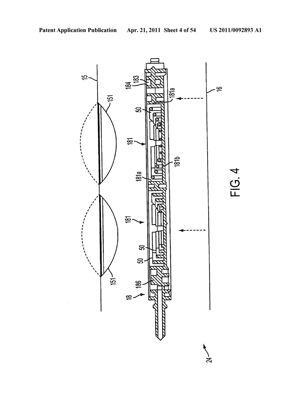 MEDICAL TREATMENT SYSTEM AND METHODS USING A PLURALITY OF FLUID LINES - diagram, schematic, and image 05