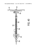 MEDICAL TREATMENT SYSTEM AND METHODS USING A PLURALITY OF FLUID LINES diagram and image