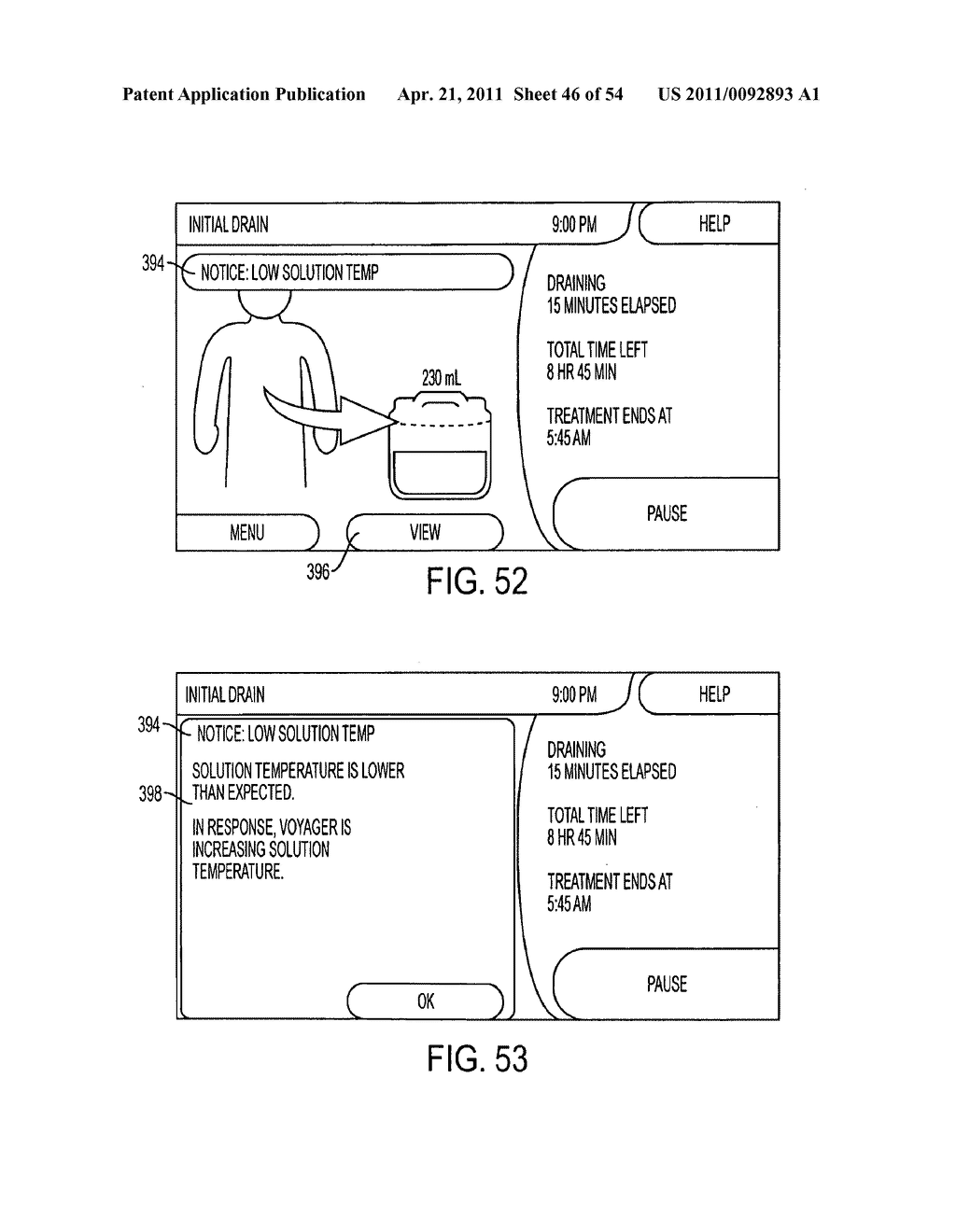 MEDICAL TREATMENT SYSTEM AND METHODS USING A PLURALITY OF FLUID LINES - diagram, schematic, and image 47