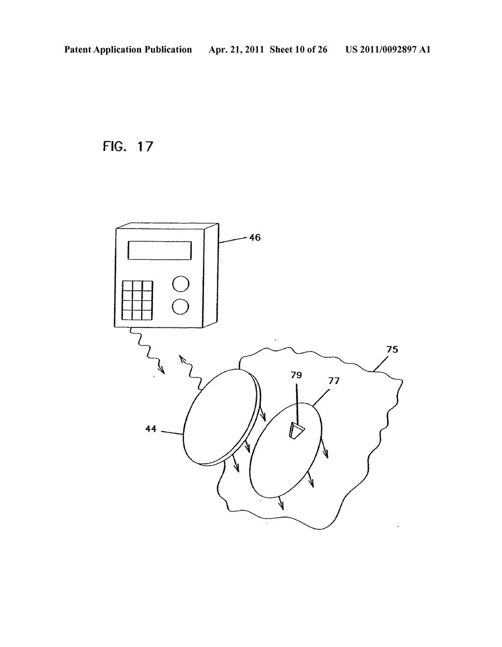 Analyte Monitoring Device and Methods of Use - diagram, schematic, and image 11