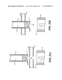 CATHETER ASSEMBLY INCLUDING INTERNAL BOLSTER diagram and image