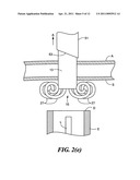 CATHETER ASSEMBLY INCLUDING INTERNAL BOLSTER diagram and image