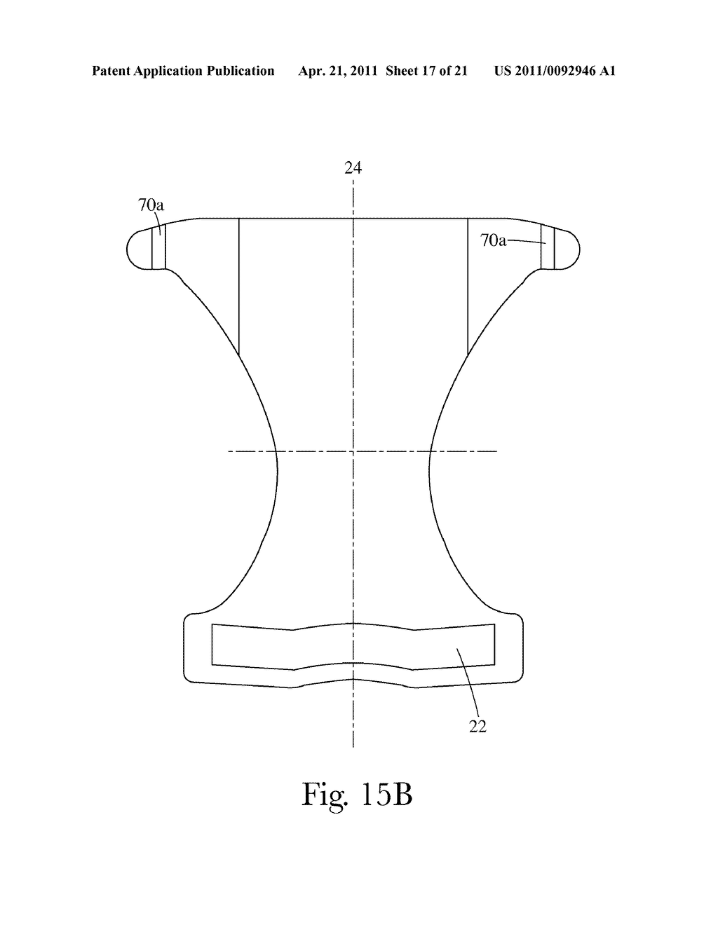 Wearable Article with Extensible Fastening Member Having Stress Distribution Features and/or Fastening Combination Performance Characteristics, and Method of Testing and Selecting Fastening Combination Performance Characteristics - diagram, schematic, and image 18