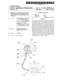 Remotely Activated Piezoelectric Pump for Delivery of Biological Agents to the Intervertebral Disc and Spine diagram and image