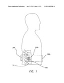 Remotely Activated Piezoelectric Pump for Delivery of Biological Agents to the Intervertebral Disc and Spine diagram and image