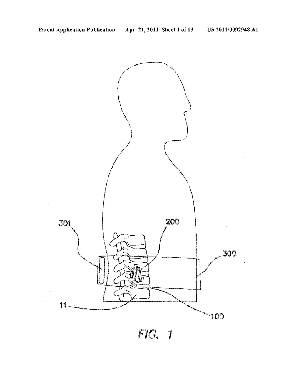 Remotely Activated Piezoelectric Pump for Delivery of Biological Agents to the Intervertebral Disc and Spine - diagram, schematic, and image 02