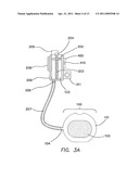 Remotely Activated Piezoelectric Pump for Delivery of Biological Agents to the Intervertebral Disc and Spine diagram and image