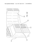 Remotely Activated Piezoelectric Pump for Delivery of Biological Agents to the Intervertebral Disc and Spine diagram and image