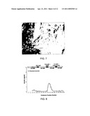 IMMUNOISOLATION PATCH SYSTEM FOR CELLULAR TRANSPLANTATION diagram and image