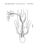 Pressure-Sensing Medical Devices, Systems and Methods, and Methods of Forming Medical Devices diagram and image