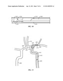 Pressure-Sensing Medical Devices, Systems and Methods, and Methods of Forming Medical Devices diagram and image