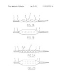 BALLOON CATHETER AND METHOD FOR MANUFACTURING IT diagram and image