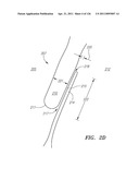 SYSTEMS AND METHODS FOR TREATING SEPTAL DEFECTS diagram and image