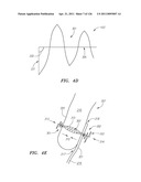 SYSTEMS AND METHODS FOR TREATING SEPTAL DEFECTS diagram and image