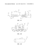 SYSTEMS AND METHODS FOR TREATING SEPTAL DEFECTS diagram and image