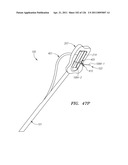 SYSTEMS AND METHODS FOR TREATING SEPTAL DEFECTS diagram and image