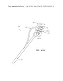 SYSTEMS AND METHODS FOR TREATING SEPTAL DEFECTS diagram and image