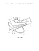 SYSTEMS AND METHODS FOR TREATING SEPTAL DEFECTS diagram and image