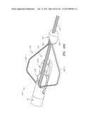 SYSTEMS AND METHODS FOR TREATING SEPTAL DEFECTS diagram and image