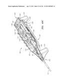 SYSTEMS AND METHODS FOR TREATING SEPTAL DEFECTS diagram and image