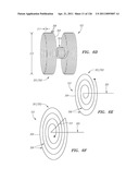 SYSTEMS AND METHODS FOR TREATING SEPTAL DEFECTS diagram and image