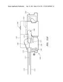 SYSTEMS AND METHODS FOR TREATING SEPTAL DEFECTS diagram and image