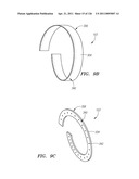 SYSTEMS AND METHODS FOR TREATING SEPTAL DEFECTS diagram and image