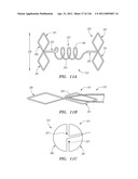 SYSTEMS AND METHODS FOR TREATING SEPTAL DEFECTS diagram and image