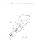 SYSTEMS AND METHODS FOR TREATING SEPTAL DEFECTS diagram and image