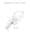 SYSTEMS AND METHODS FOR TREATING SEPTAL DEFECTS diagram and image