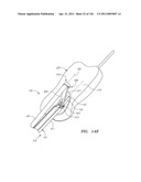 SYSTEMS AND METHODS FOR TREATING SEPTAL DEFECTS diagram and image