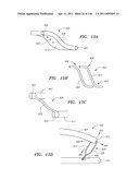 SYSTEMS AND METHODS FOR TREATING SEPTAL DEFECTS diagram and image