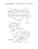 SYSTEMS AND METHODS FOR TREATING SEPTAL DEFECTS diagram and image