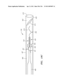 SYSTEMS AND METHODS FOR TREATING SEPTAL DEFECTS diagram and image