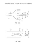 SYSTEMS AND METHODS FOR TREATING SEPTAL DEFECTS diagram and image