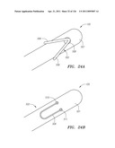 SYSTEMS AND METHODS FOR TREATING SEPTAL DEFECTS diagram and image