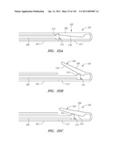 SYSTEMS AND METHODS FOR TREATING SEPTAL DEFECTS diagram and image