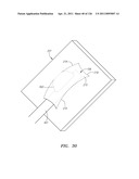 SYSTEMS AND METHODS FOR TREATING SEPTAL DEFECTS diagram and image