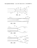 SYSTEMS AND METHODS FOR TREATING SEPTAL DEFECTS diagram and image